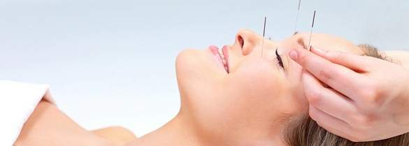 Carnival Cruise Lines Acupuncture.jpg